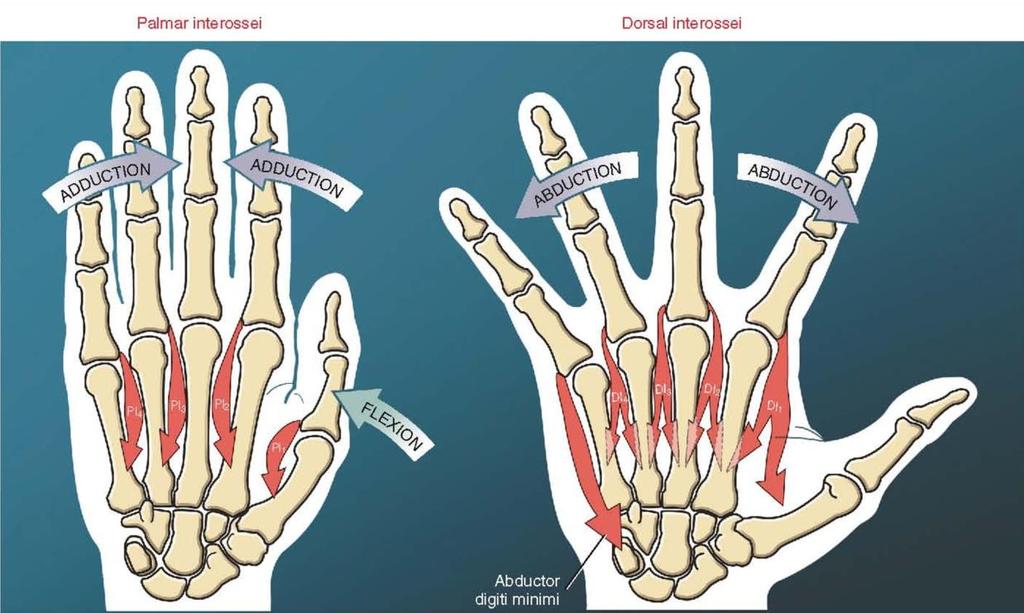 Intrinsic muscles of the hand 등쪽뼈사이근은 MP 관절의굽힘, PIP 관절 DIP