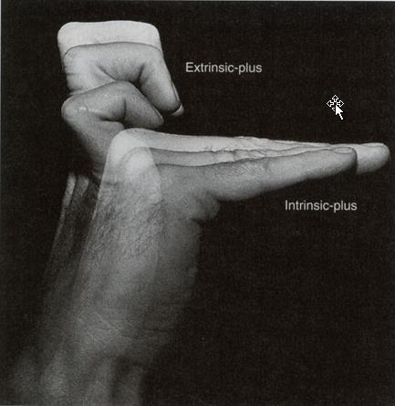 Interaction of the extrinsic and intrinsic muscles of the fingers Intrinsic-plus