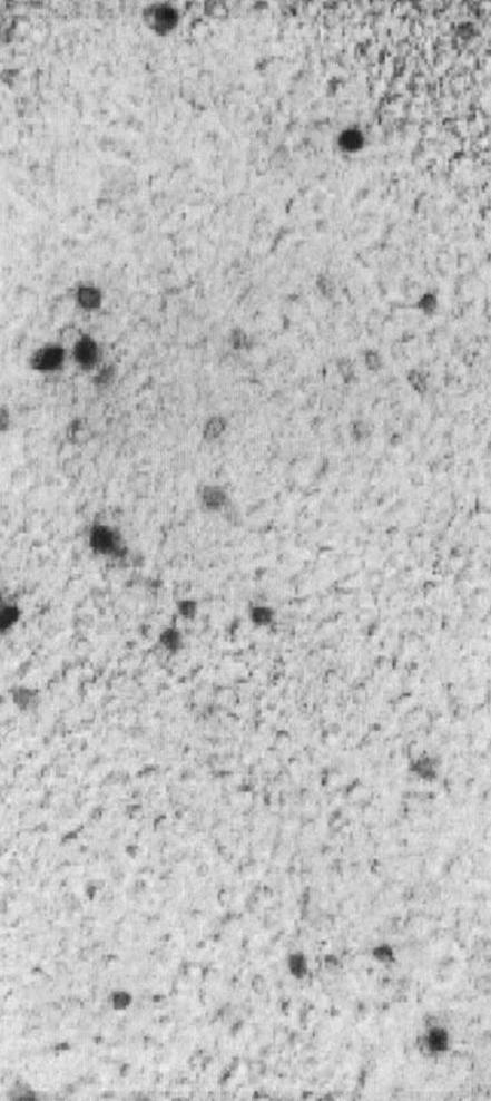 Dark staining represented successful β-galactosidase gene expression in the cells. The expression of β-galactosidase in cultured C6 glioma cells.