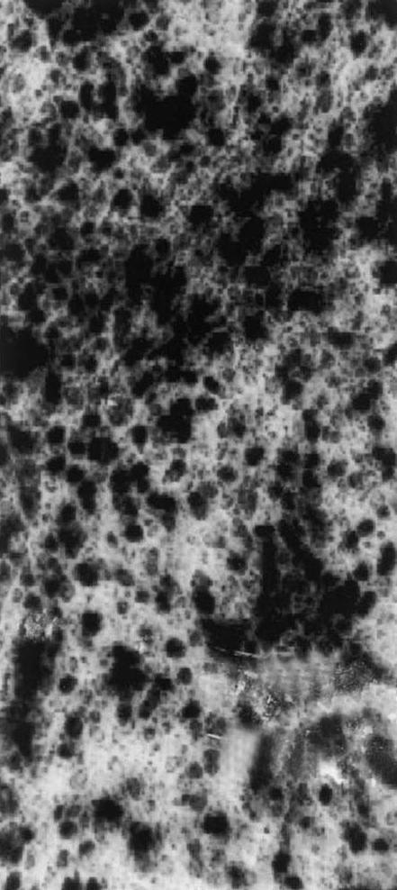 높은 중복 감염지 CDTK C6 cells 293 cells Fig. 2. The expression of CD/TK in C6 glioma or 293 cells.