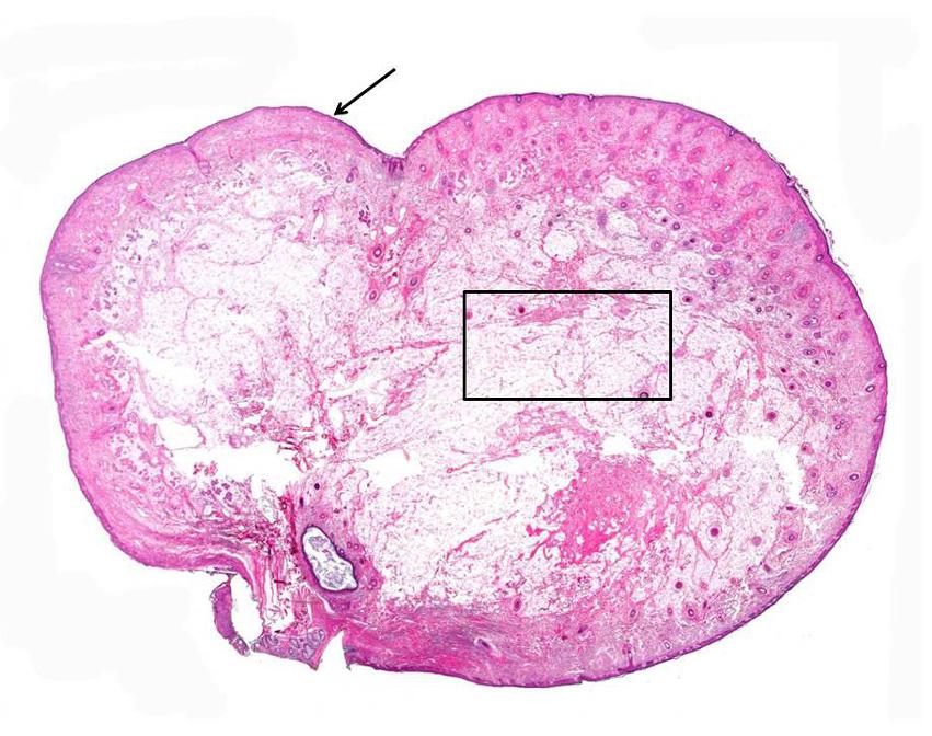 원시배아세포는제태기간 3 4주에제대낭 (umbilical vesicle) 벽의내배엽에서관찰되며, 뒤창자 (hindgut) 의등쪽장간막에서중간엽 (mesenchyme) 을지나생식샘능선 (gonadal ridge) 을향해이동한다.