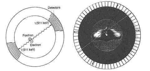 양전자방출단층촬영 Positron emissition tomography (PET) 11 C ( 반감기 20.