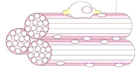 Pain Relief Degenerating axons Motor