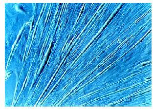 Cell Sources Somatic Cell Somatic Stem Cell