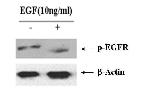 Ⅲ. 연구결과 1.EGFR 의발현 구강암의 YD-10B 세포주에서 EGFR 의발현을조사하기위해 Western bloting 을시행하였다.YD-10B 세포주에서 EGFR 의발현은정상구강점막의각화세포 (NK) 에비하여과발현되었다 (Figure 2A).