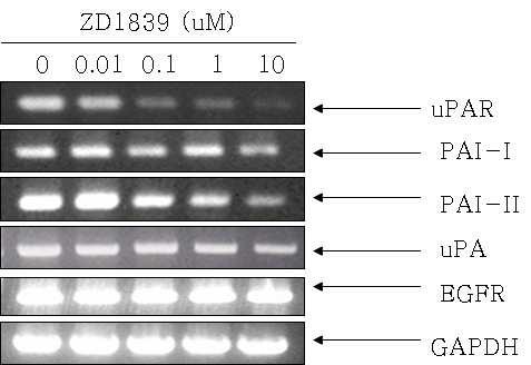 Figure 7.Efects ofzd1839 on the transcriptionallevelofmmp-2 and MMP-9. A.YD-10B celsweretreatedwith ZD1839attheconcentration of0,0.01, 0.