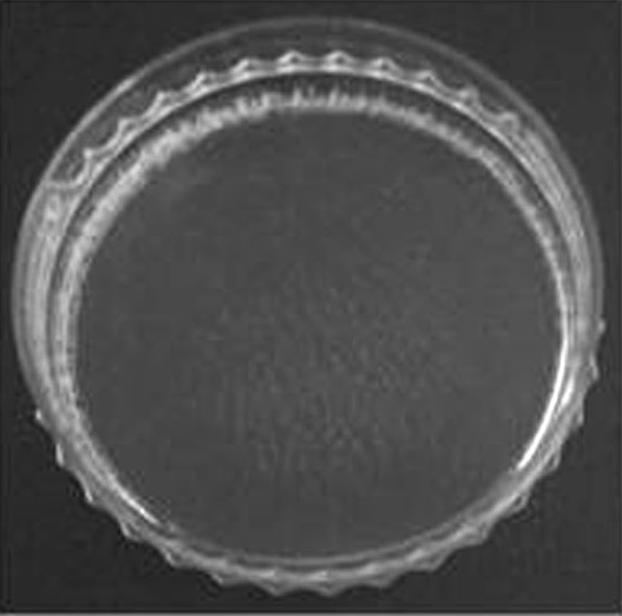 빛간섭단층촬영(Fourier-Domain Optical Coherence 하였다.