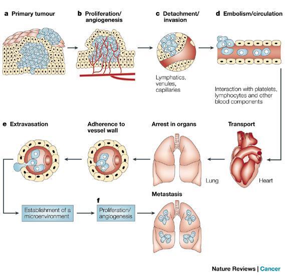 23 Figure 3: The pathogenesis of cancer metastasis. The process of metastasis can stop in any of these steps.