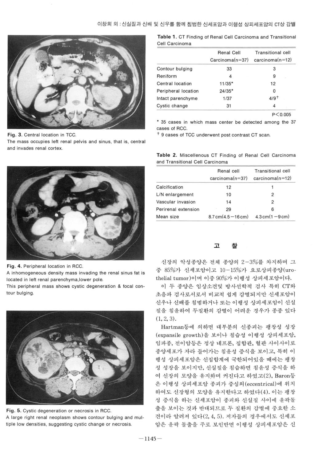 이창희외 : 신실질과신배및신우를함께침범한신세포암과이행성상피세포암의 CT 상감별 Table 1.