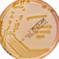 배지및시약가이드 Sabouraud Dextrose Agar (CM0041) 혈액한천배지 (CM0055+SR0051) 난황첨가