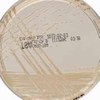at 32 ± 1 C, aerobic 살모넬라 : 담황색집락 Staphylococcus aureus ATCC 33591 18