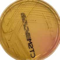 Campylobacter jejuni ATCC 33291 40 48 hr.