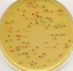 RPF 한천배지 (CM0961+SR0122) Escherichia coli ATCC 25922