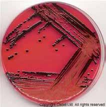 at 36 ± 1 C, aerobic Staphylococcus.