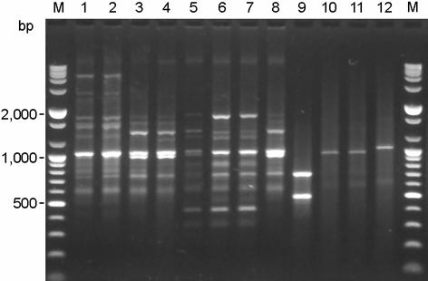 84 장경수, 오재영, 강희영, 진종숙, 설성용, 김정민, 이제철, 조동택, 이유철 4. 동일한환자에서분리된균주에의한 RAPD 분석과 PFGE 의비교 Figure 4. DNA fingerprinting profiles of RAPD of S. maltophilia with 10 mer primer.