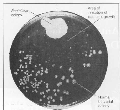 Fleming s Petri Dish 1928 년어느날포도상구균계통의화농균을배양하다가