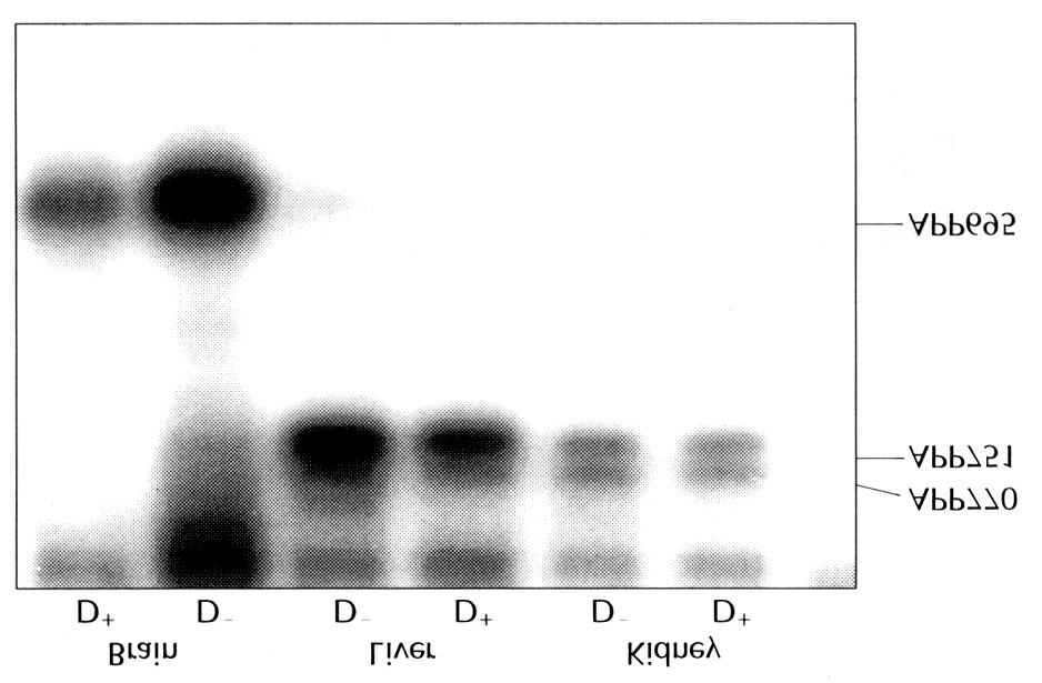 현되었다. 반면, 신장과 간조직에서는 APP770과 APP751 결과, APP695의 mrna는 1일, 3일째에는 감소하는 것으로 이 주로 발현되었으며, 특히 신장에서는 APP751이 주로 보였으나 수술하기 전과 비교할 때 3일째에만 유의하게 감소 발현되는 것으로 나타났다(Fig. 4 D ). RT-PCR에 대한 하였다(p<0.05).
