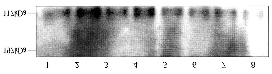 PCR products of 331, 274, 197bp equivalent to APP770, APP751, APP695 were obtained. Fig. 3. Amplication cycle-dependent PCR amplication of APP695 cdna. Fig. 4.