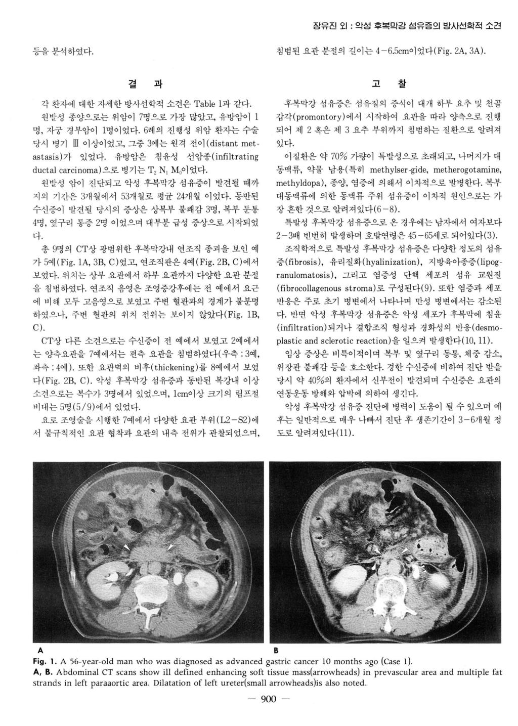 장유진오 1: 악성후복막강섬유증의밤시선학적소견 등을분석하였다. 침범된요관분절의길이는 4-6.5cm이었다 (Fig. 2A, 3A). 7~.. 1 2 -, 고 찰 각환자에대한자세한방사선학적소견은 Table 1 과같다. 원발성종양으로는위암이 7 명으로가장많았고, 유방암이 1 명, 자궁경부암이 1 명이었다.