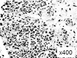 박영은외 : IL-15 Induced SDF-1 in RA FLS 신장을위해 72