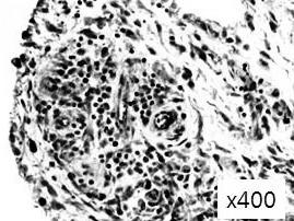 MTT assay 96 well plate에 1 10 3 /ml의농도로세포를배양하여, ITSA가포함된 serum free DMEM 배양액으로 starvation한다.