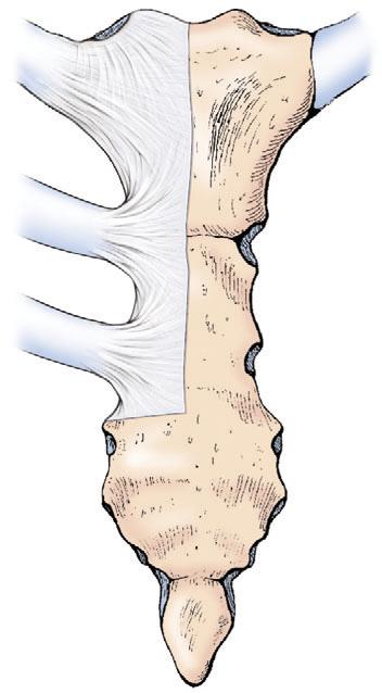 (, costal notch)., (sternebrae, primordial segments of sternum).