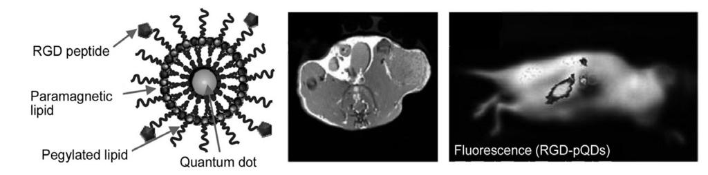 MMP dependence of MMP activatable gold nanoparticles, (C) NIR fluorescence imaging, Fluorescence intensity is emitted in only tumor site by MMP cleavage of peptide substrate that