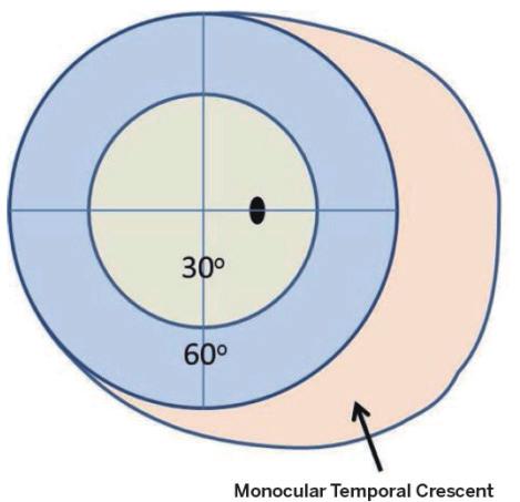 Kang B-H, et al. Visual Field Defects A B Fig. 1. Normal visual field. (A) The normal island of vision, (B) Diagram of the visual field for the right eye.