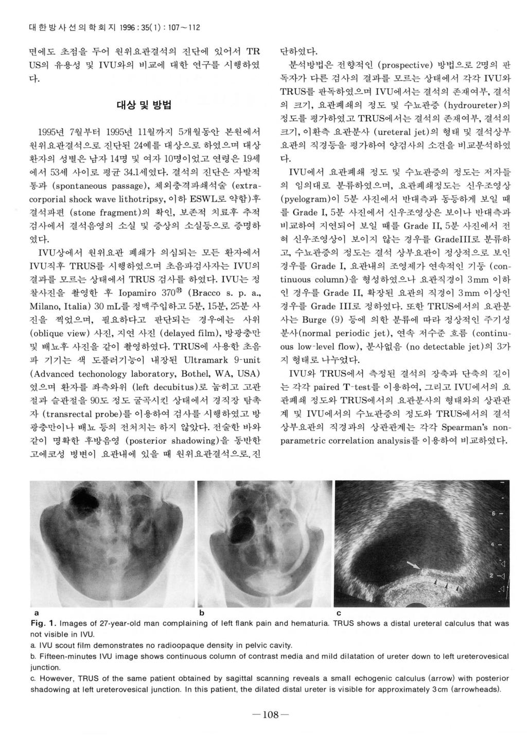 대한밤사선의학회지 1996 : 35( 1) : 107-112 변에도초점을두어원위요관결석의진단에있어서 TR US의유용성및 IVU와의비교에대한연구를시행하였다. 대상및방법 1 995년 7월부터 1995년 11월까지 5개월동안본원에서원위요관결석으로진단된 2예를대상으로하였으며대상환자의성별은남자 1명및여자 10명이었고연령은 19세에서 53세사이로평균 3.1세였다.