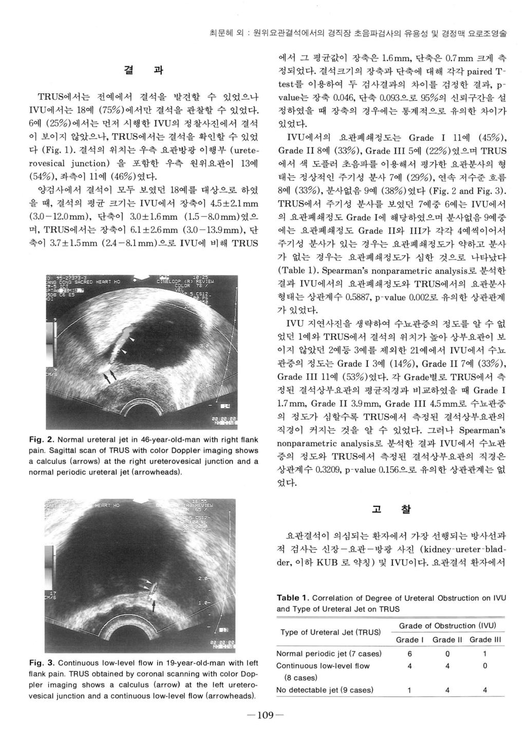 최문혜외 원위요관걸석에서의경직장초음파검사의유용성및경정맥요로조영술 결 TRUS 에서는전예에서 과 결석을발견할수있였으나 IVU 에서는 18 예 (75%) 에서만결석을관찰할수있었다. 6 예 (25%) 에서는먼저시행한 IVU 의정찰사진에서결석 이보이지않았으나, TRUS 에서는결석을확인할수있었 다 (Fig. 1).