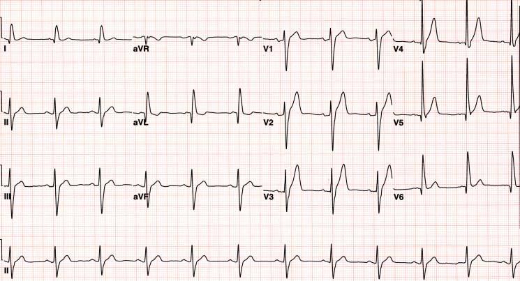 CASE 10-2 EKG at OPD 05, Kim