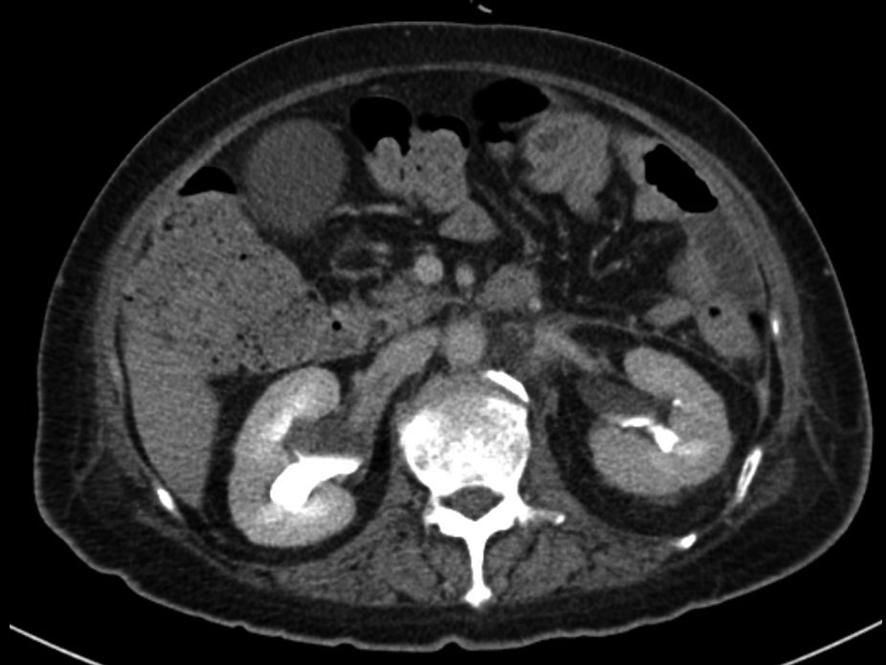 normal appearance (hematoxylin