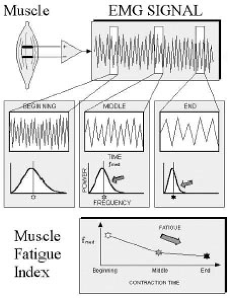 EMG 근전도 EEG 뇌전도 hp://e.wikipedia.