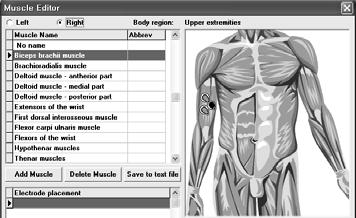 lesios diffuse lesios meabolic ecephalopahy hydrocephalus deep midlie lesios.