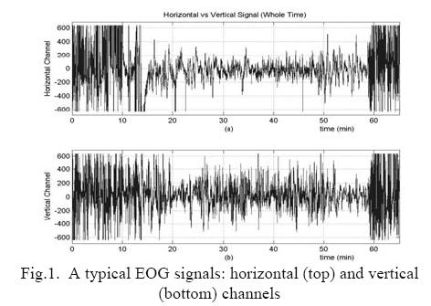 hp://e.wikipedia.org/ 에서 EEG 찾기 ype Dela Frequecy (Hz) up o 3 Wave Paers hea 4 7 Alpha 8 Bea 3 Gamma 34-3 EOG 안구전도 hp://www.