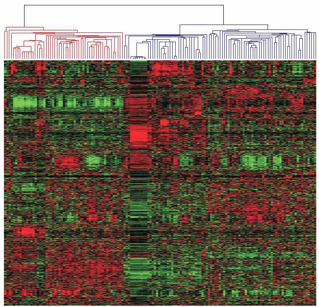 침윤성방광암환자가크게유전자발현패턴이확연히다 른두개의그룹으로나뉨을확인할수있음 (4,456 genes by SD > 0.7) ( 그림 x).