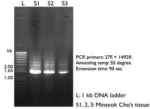 LET7G,MIR326,MIRLET7B,MIR204,MIR296,MIR30E,MIR181A2,MIR152-05 epithelial to mesenchymal transition MIR155,MIR192,MIR10B,MIR200C,MIR215,MIR141,MIR200B,MIR429 7.