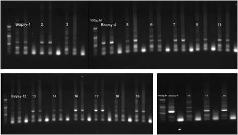 [ 그림 46] 16S rrna gene 분석을위한 amplicon 위치 [ 그림 47] pyrosequencing 을위한 amplicons (2) 대용량 DNA sequencing 을통한군집구조조사