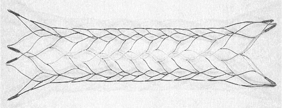 5). Solitaire (ev3, USA) Laser-cut 제작이고, closed-cell 구조인것, 그리고기존의마이크로카테타를이용하여올릴수있는것은 Fig. 4. A figure of Leo stent. It is a closed cell type self expandable stent. Enterprise 스텐트와유사하다 (Fig. 6).