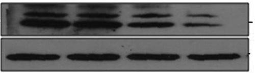 Journl of Nutrition nd Helth (J Nutr Helth) 213; 46(6): 53 ~ 51 / 57 cl-2 28 kd x 28 kd β-ctin 42 kd β-ctin 42 kd NS 2 Fig. 6. Effects of delphinidin on cl-2 expression in MD-M-231 cells.