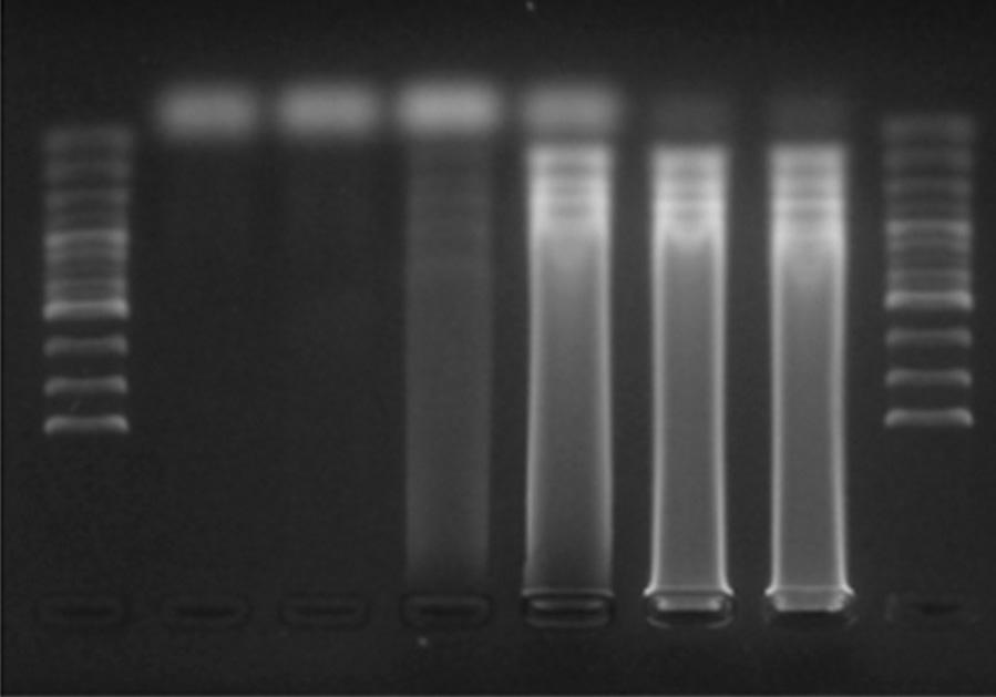 RT-LAMP와 RT-PCR의민감도를비교하기위하여 RT-LAMP와 RT-PCR을동일한전체 RNA를주형으로 260 ng/μl에서 2.6 10 6 ng/μl까지단계적으로 10배씩희석하여반응을수행하였다. 기기에따른재현성확인.