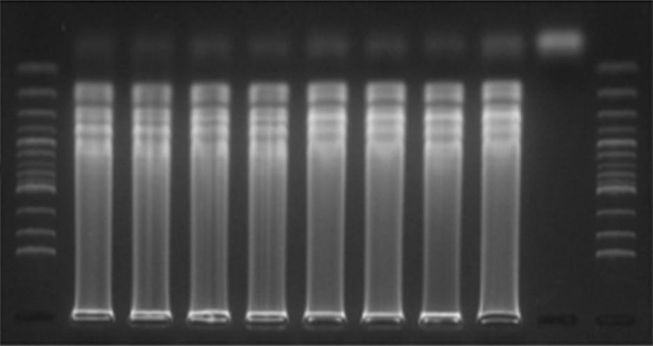 Lane M, 100 bp DNA ladder; lane 1, Soybean yellow mottle mosaic virus; lane 2, Soybean mosaic virus; lane 3, Soybean yellow common mosaic virus; lane 4, Peanut stunt virus; lane 5, Bean common mosaic