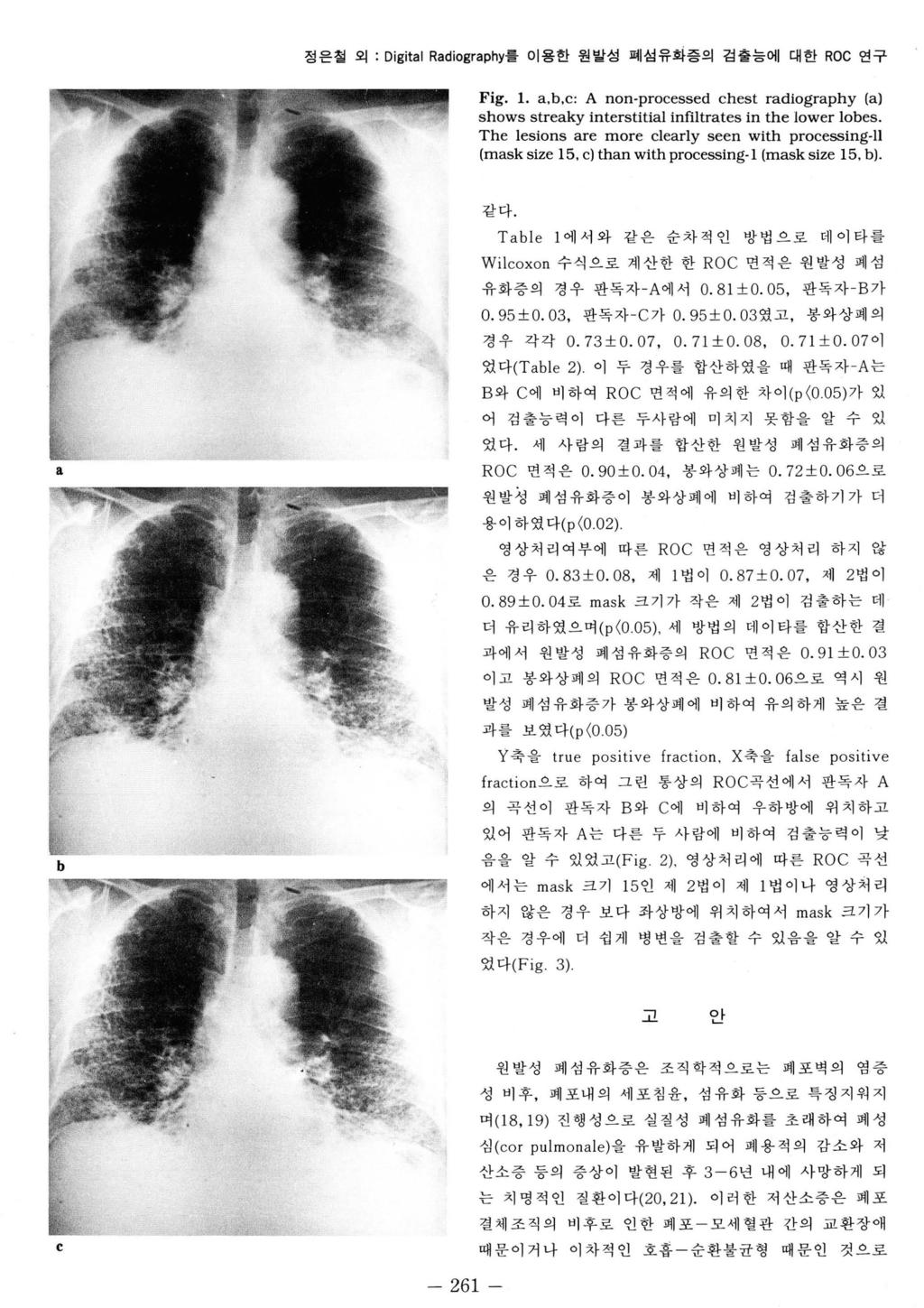 정은철외 : Digital Radiography 를이용한원발성폐성유화증의겁출능에대한 ROC 연구 Fig. 1. a.b.c: A non-processed chest radiography (a) shows streaky interstitial infiltrates in the lower lobes.