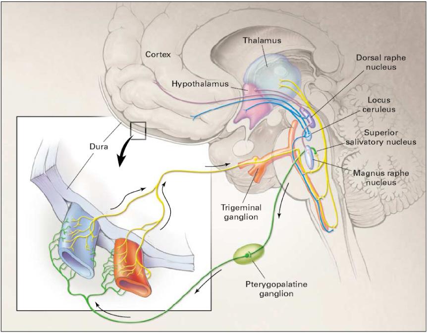 편두통의기능적뇌영상 Figure 1. Migraine involves dysfunction of brainstem pathways that normally modulate sensory input.