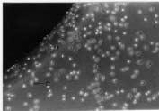 L-929 cell growth and cell attachment around Ti-15Zr-3Nb-3Ta-0.