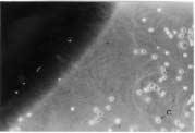 Fig. 8. Definite cell growth inhibition zone was observed around the negative control specimen(ni)(magnification X100) (M: Metal, C: L929 Cell). 이는유의성이없었고 (p 0.