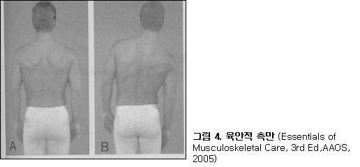 때, 후상장골극으로부터하내측 1cm