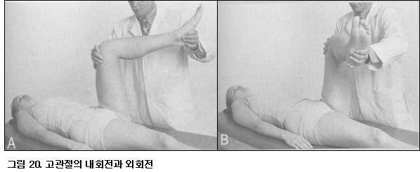 고관절의내회전 (A) 및외회전 (B) 이상근증후군