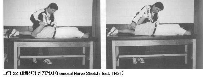 검사 대퇴신경신장검사