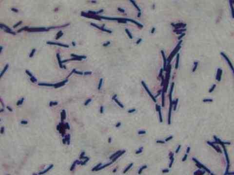 발효가잘진행된환경에있는균은대부분그람양성간균의형태로확인되었다.